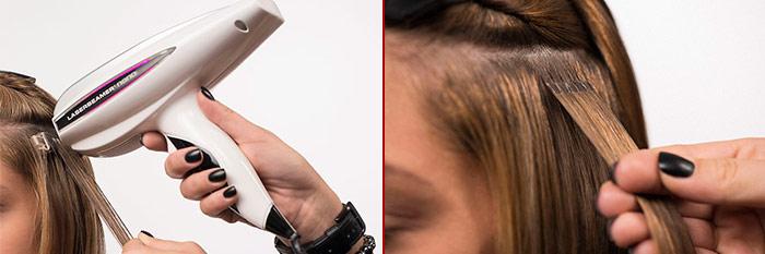как делается лазерное наращивание волос