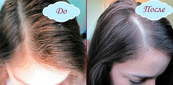 фото волос до и после применения сухого шампуня