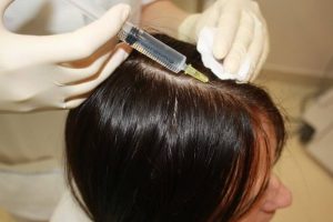 Мезотерапия волос: в чем преимущества