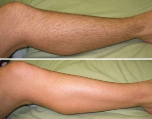 Гладкая кожа без бритв и раздражения: гид по лазерной эпиляции для тех, кто устал от ежедневной борьбы с волосами